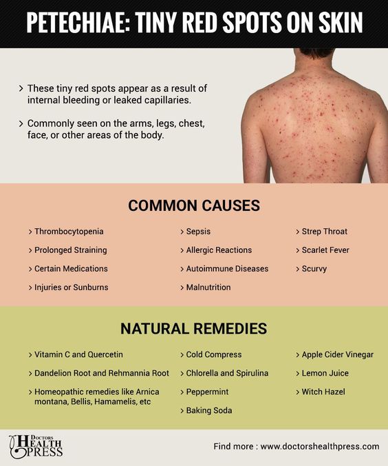 What Are These Tiny Red Spots On My Skin? Causes & Remedies